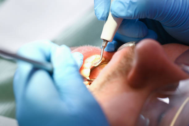 Best Mobile Emergency Dentist in Crimora, VA