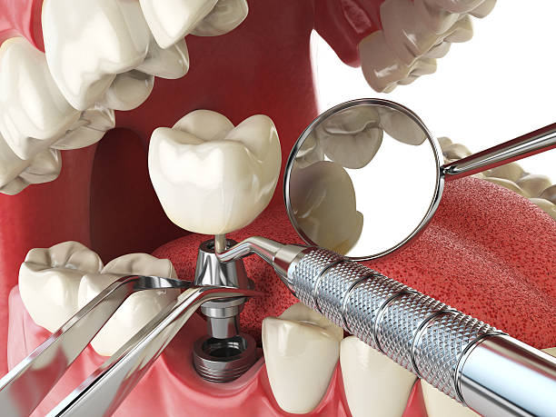 Best Emergency Dentist for Special Needs Patients in Crimora, VA